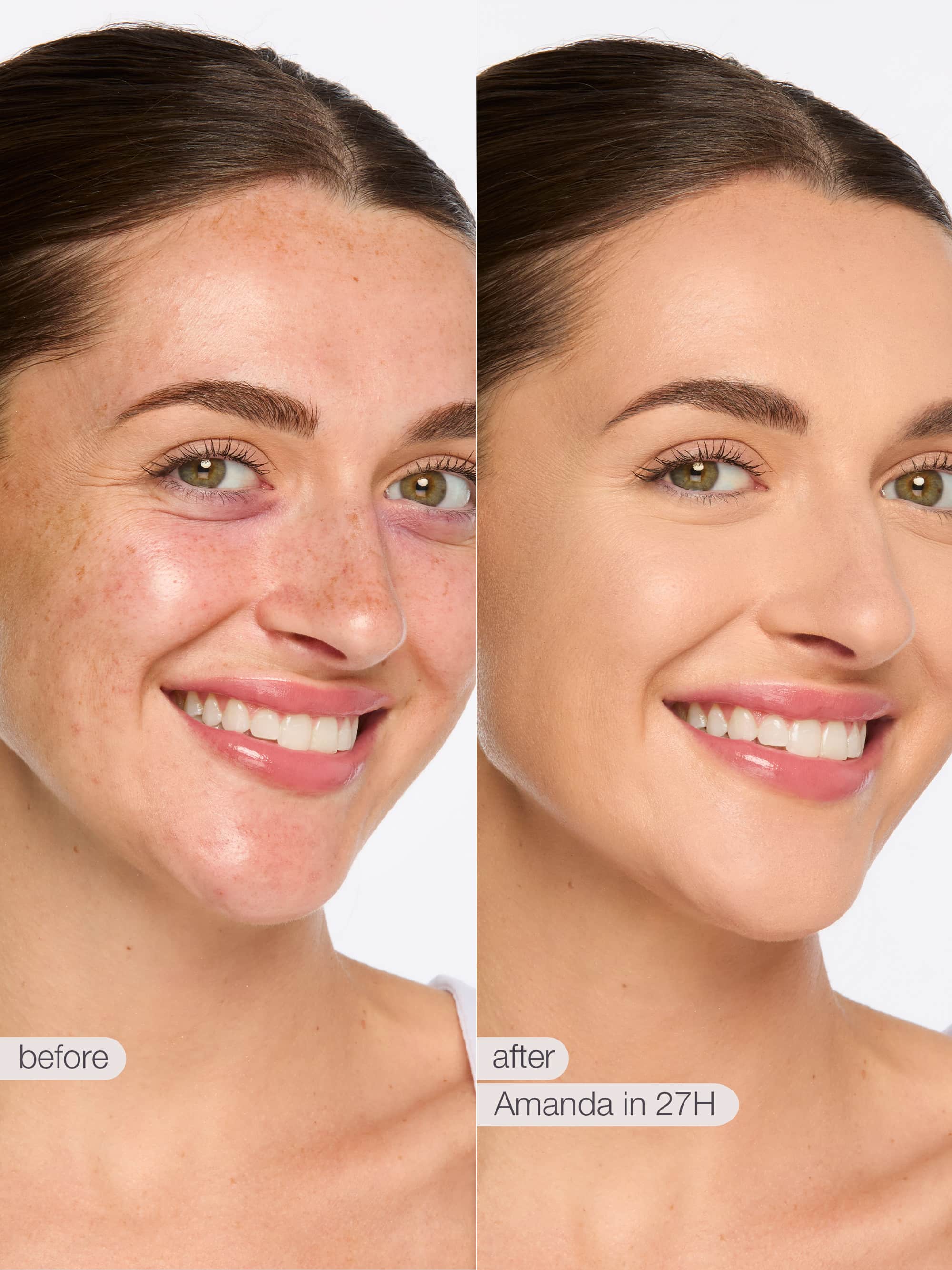 Product image 100