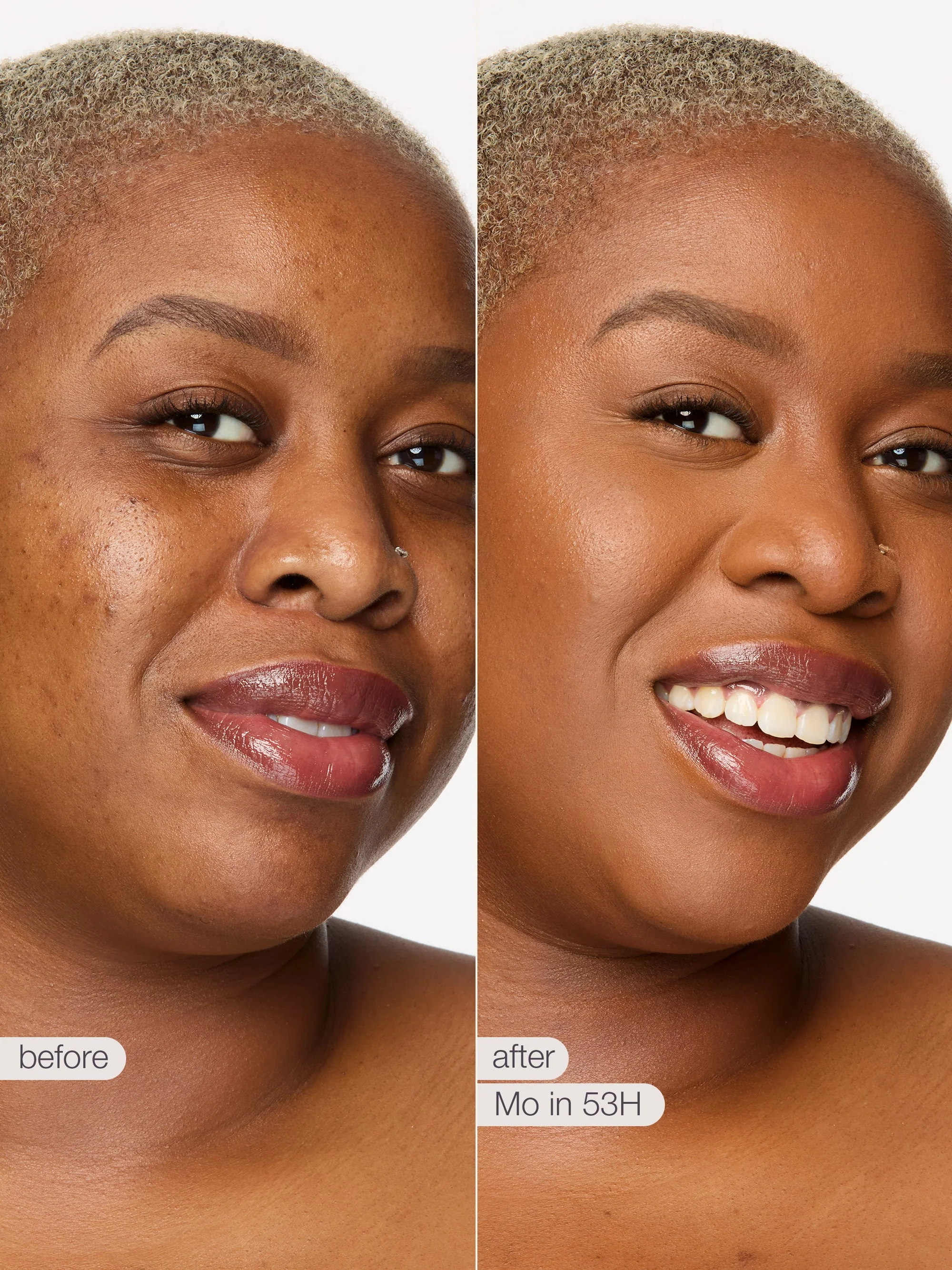 Product image 100
